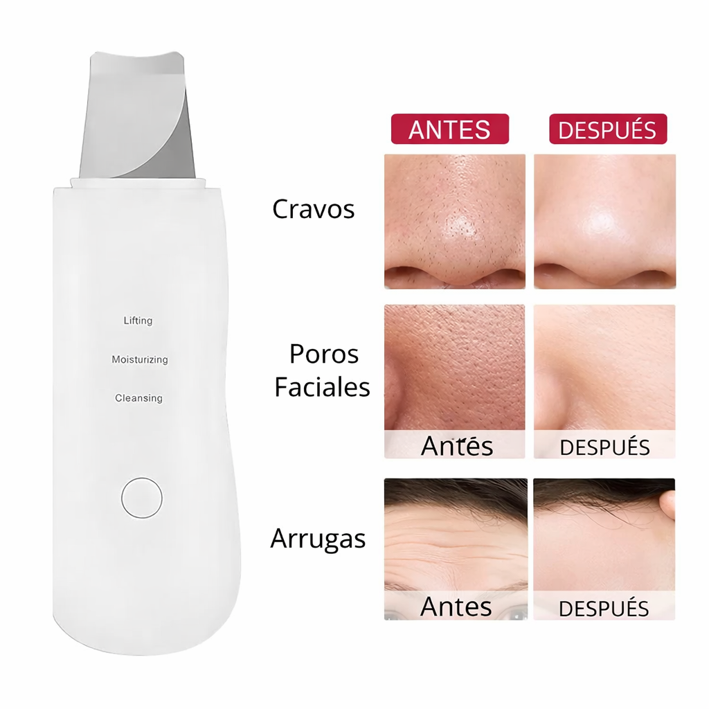 ⭐ PoreGlowPro™ 3 en 1 — Espátula ultrasónica facial que miles están usando para eliminar puntos negros, cerrar poros y rejuvenecer la piel en casa ✨💎