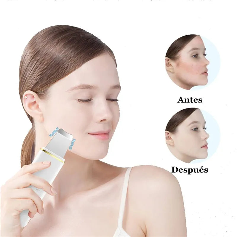 ⭐ PoreGlowPro™ 3 en 1 — Espátula ultrasónica facial que miles están usando para eliminar puntos negros, cerrar poros y rejuvenecer la piel en casa ✨💎
